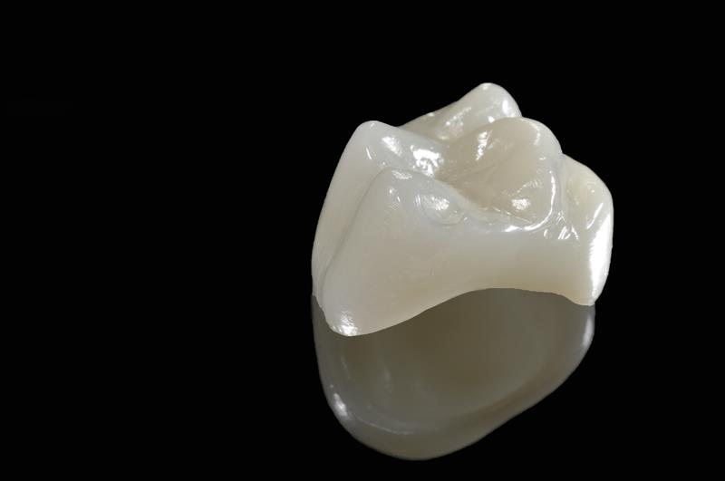 Porcelain Crowns St Charles, MO 